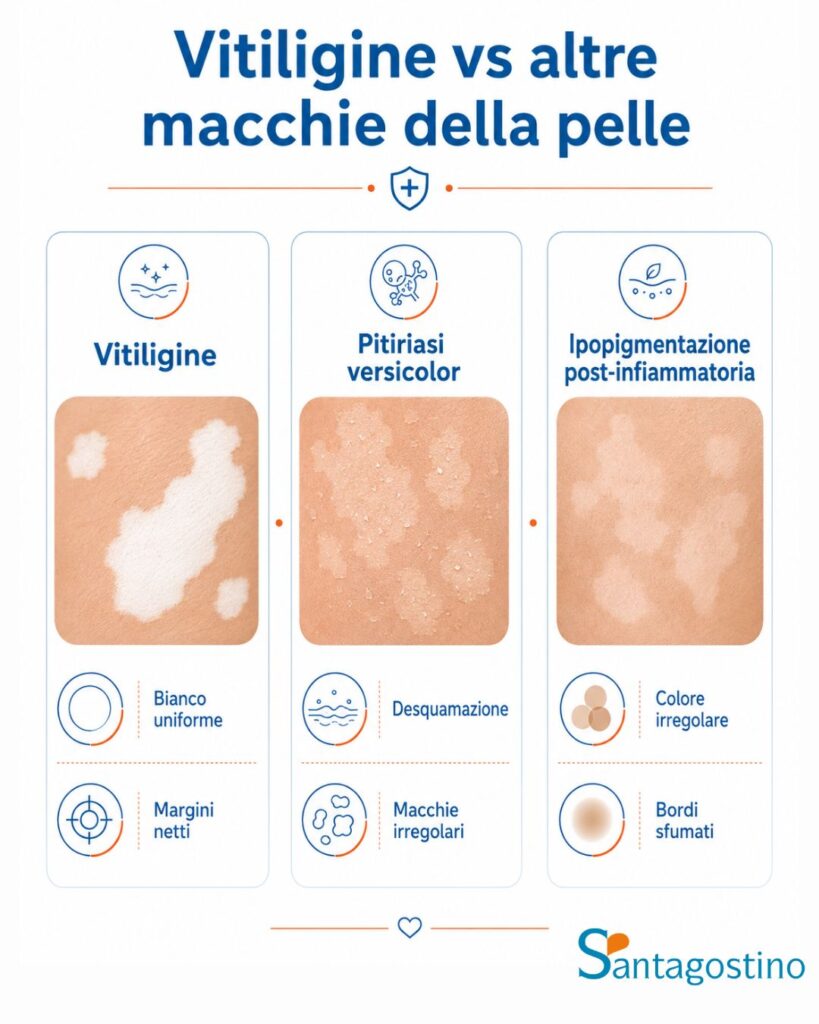 vitiligine e altre macchie le differenze