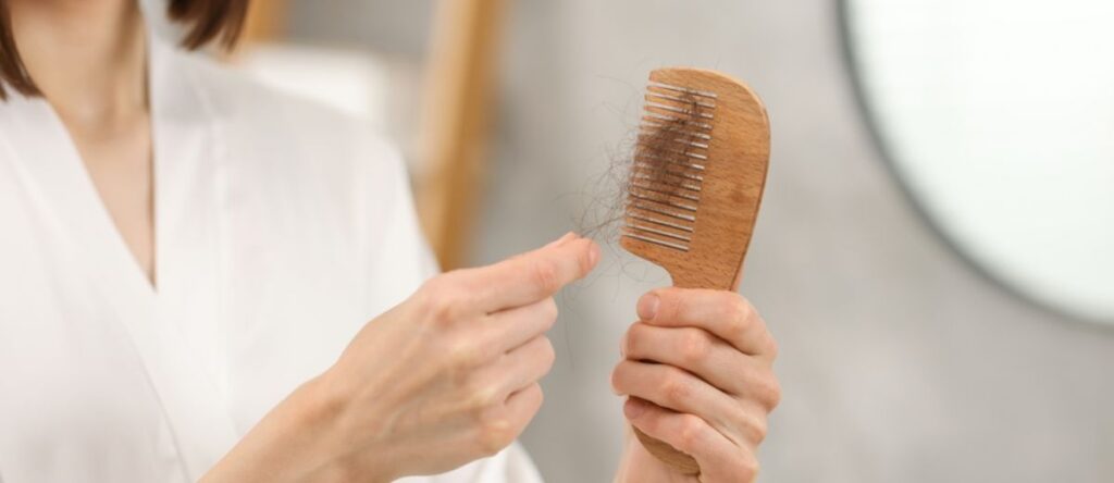 alopecia rho