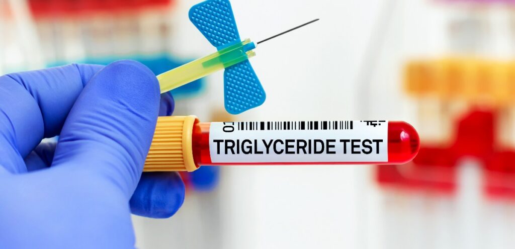 trigliceridi